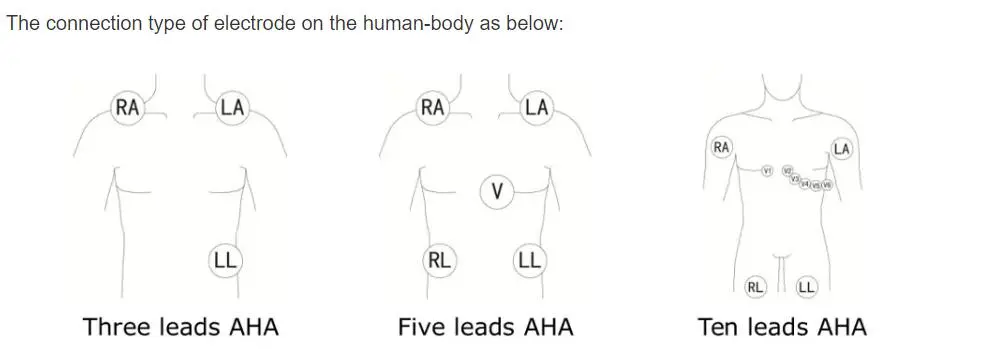Fils de dérivation ECG à 5 dérivations pour Philips Digitrak plus Holter 24 heures 3100A, 5 dérivations, Snap