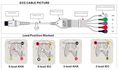 Comment connecter correctement le câble ECG avec les fils conducteurs à un mo...